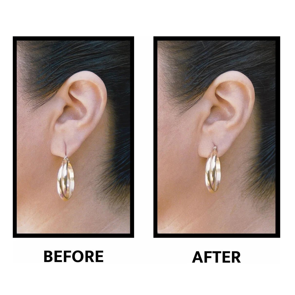 Ear Lob Support Patches - Olive You BoutiqueTHE BRADVIEA COMPANYWLW